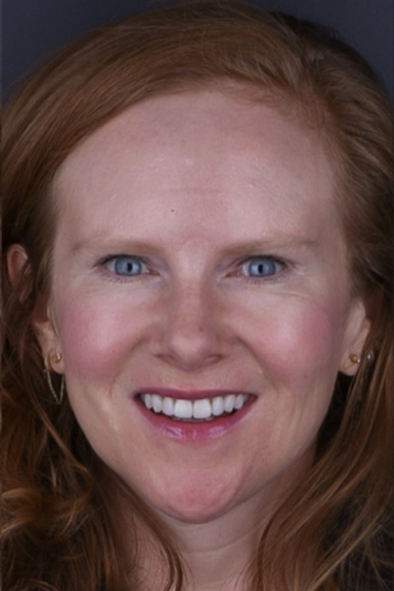 Stacy