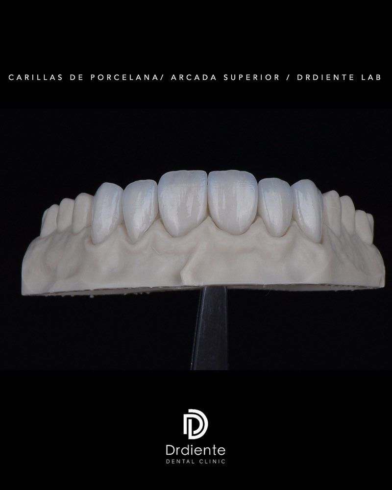 Diseño de Sonrisa